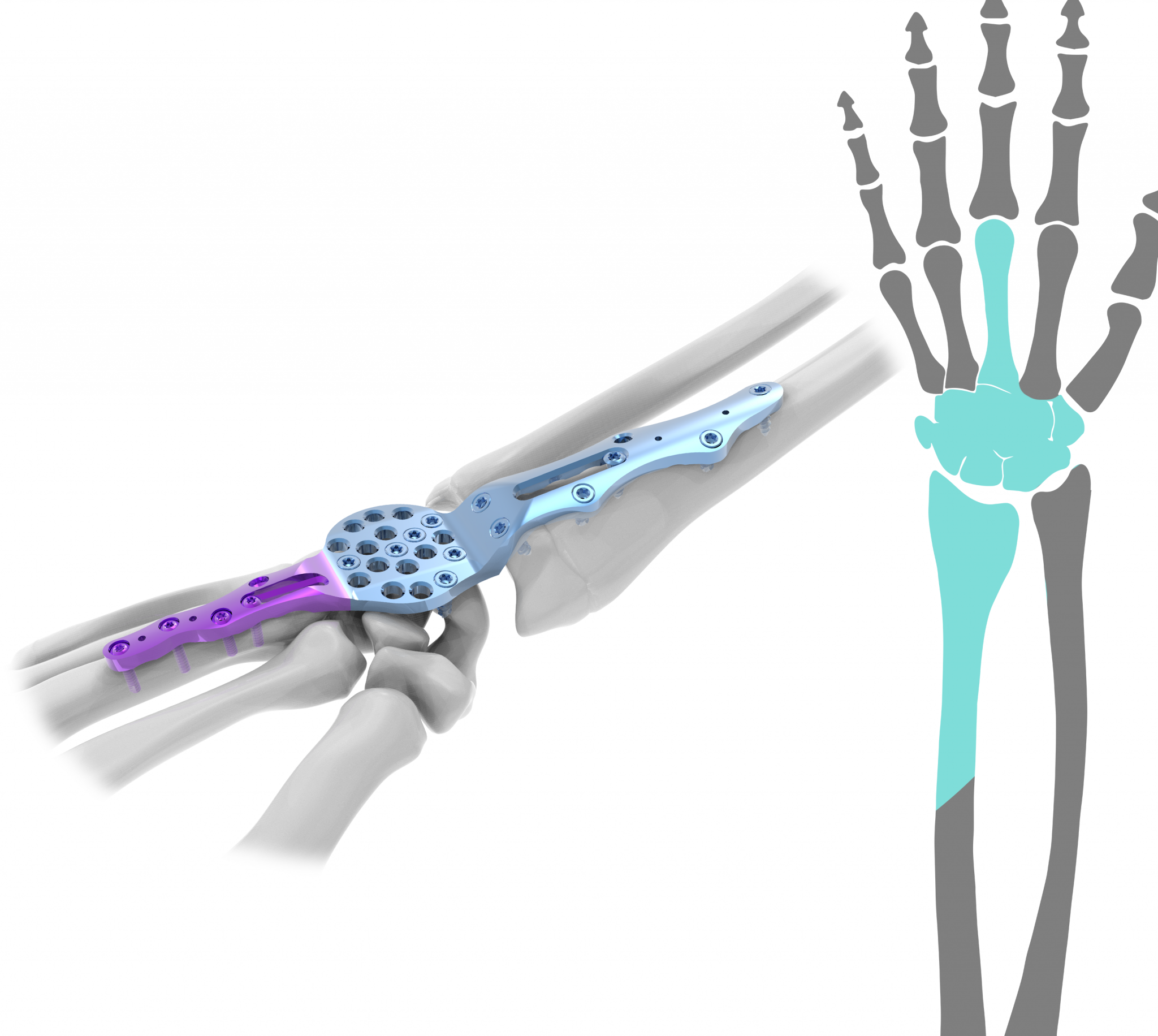 Wrist archives astrolabe
